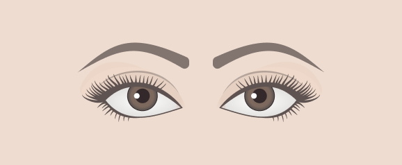 Close-set Eyes