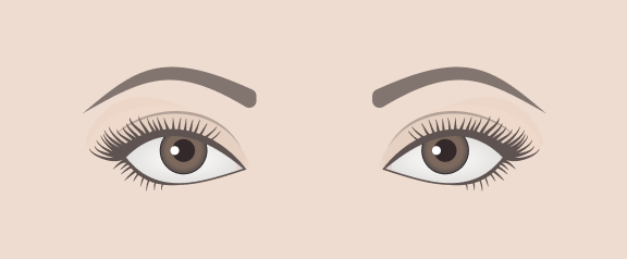 Wide-set Eyes
